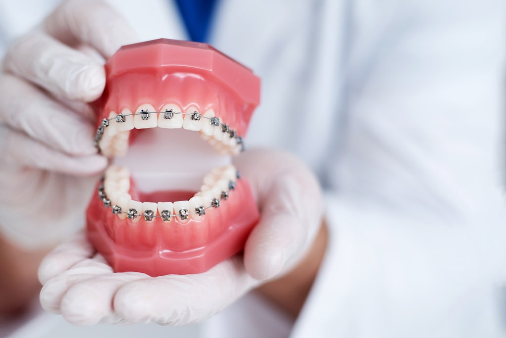 Dentist showing orthodontic model